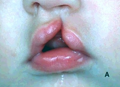 Archillect ID 135393