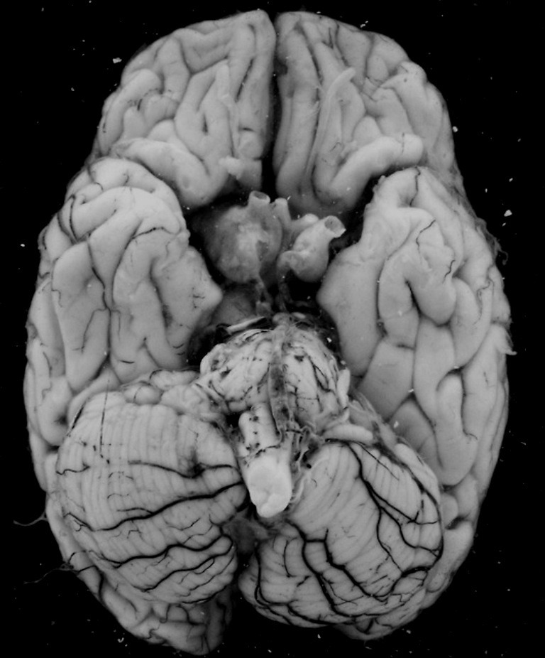 Archillect ID 371420