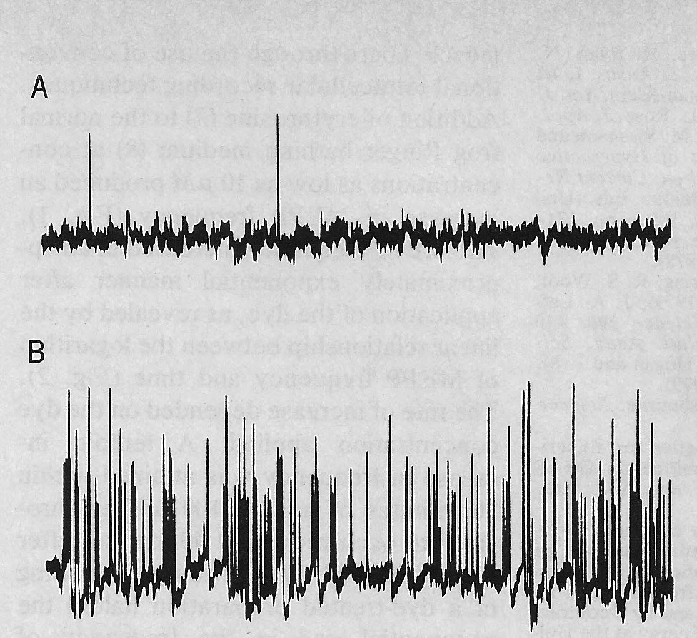 Archillect ID 382161